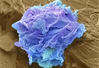 Có phải trong cơ thể con người đều có tế bào ung thư?